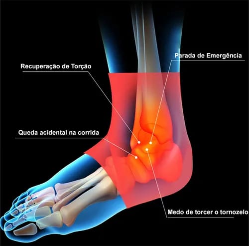 Tobilleras SecureFit